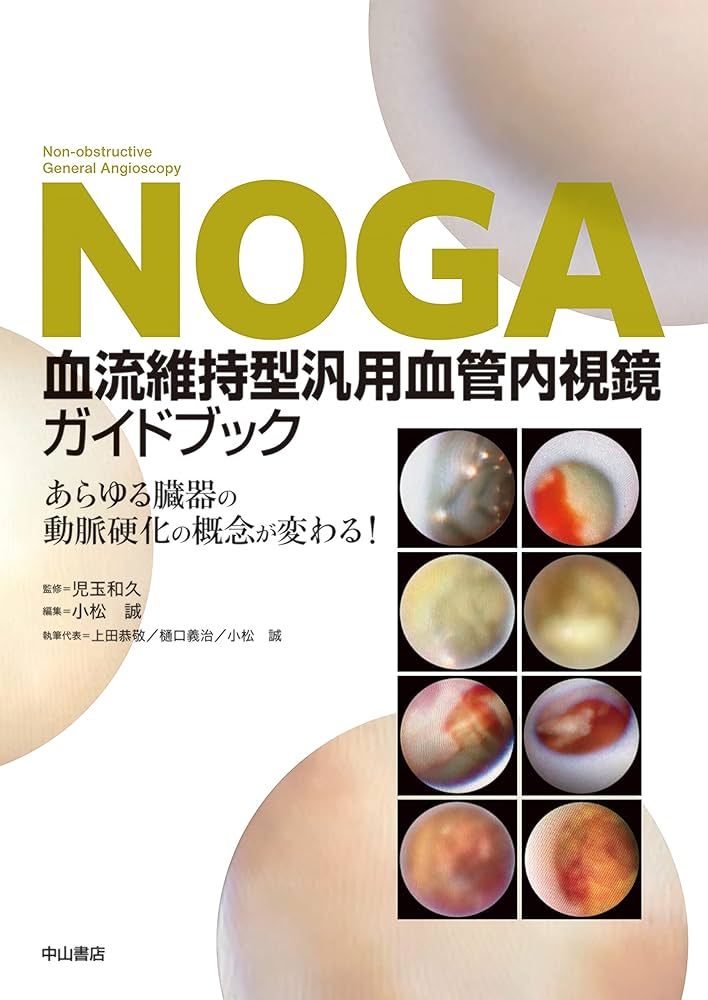 腹部血管造影ハンドブック 腹部血管造影ハンドブック 胆道外科におけるCチュ-ブ法